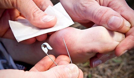 From Hiking Blisters To Dehydration First Aid Essentials On The Trail