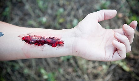 Slideshow First Aid Close Wound 1 445x260 18773 slideshow first aid close wound 1 445x260