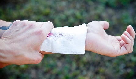 Slideshow First Aid Close Wound 2 445x260 18774 slideshow first aid close wound 2 445x260