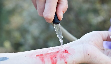 Slideshow First Aid Close Wound 3 445x260 18775 slideshow first aid close wound 3 445x260