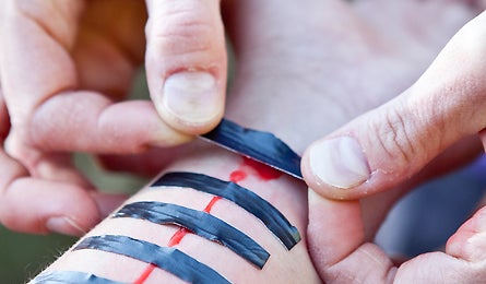 Slideshow First Aid Close Wound 4 445x260 18776 slideshow first aid close wound 4 445x260
