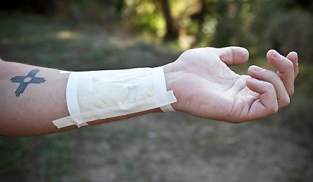 Slideshow First Aid Close Wound 6 445x260 18778 slideshow first aid close wound 6 445x260
