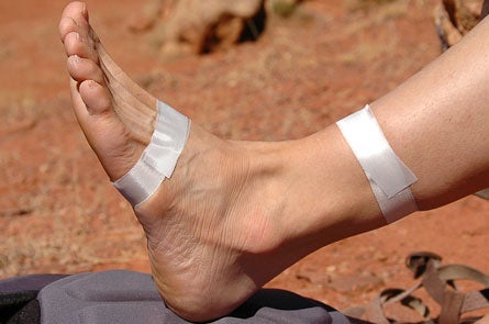 Ankle-Taping-1.jpg 29161 tape a sprained ankle