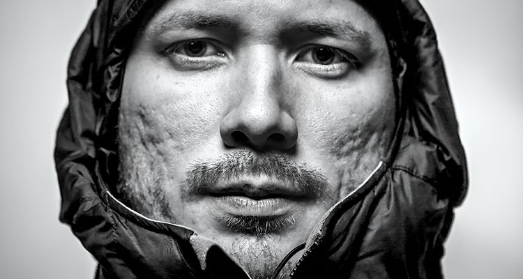 "survival hypothermia"