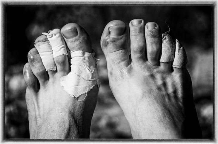 BP0618_BartSMITH_FootSoreAZTrail_gn Hiker feet