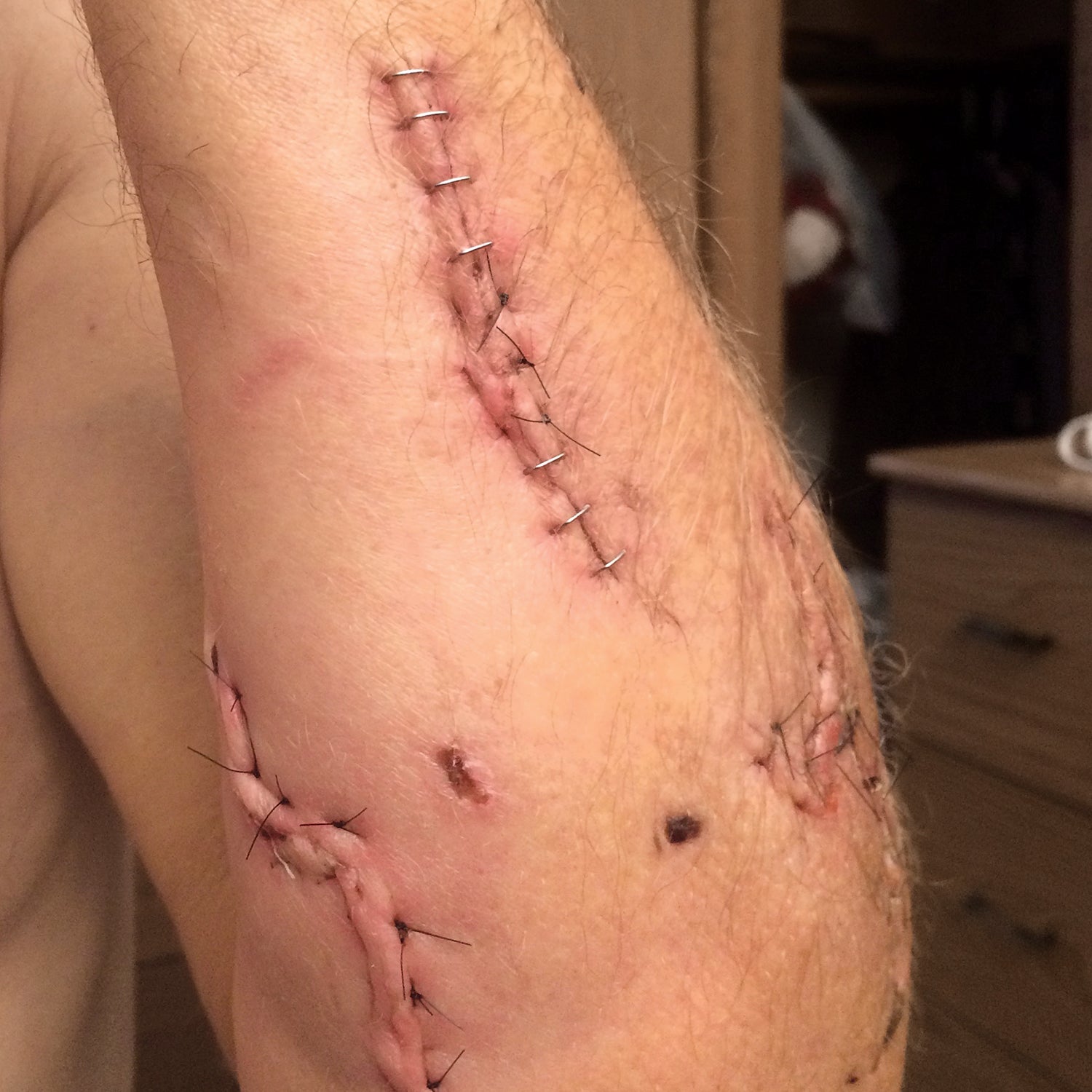 BP0617SURV_ToddOrr1097_gn Out alive attacked by a grizzly