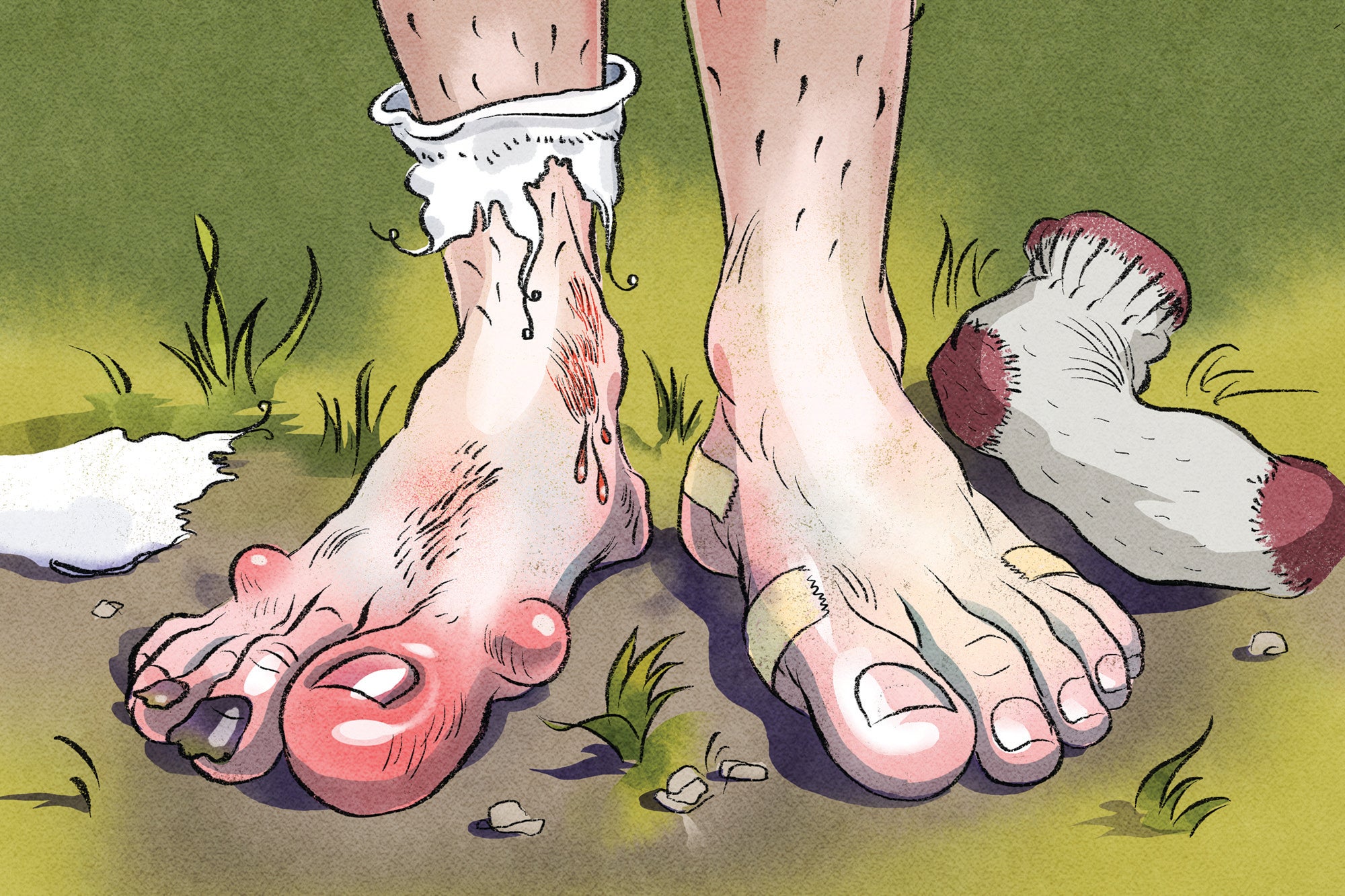 footCare Blisters