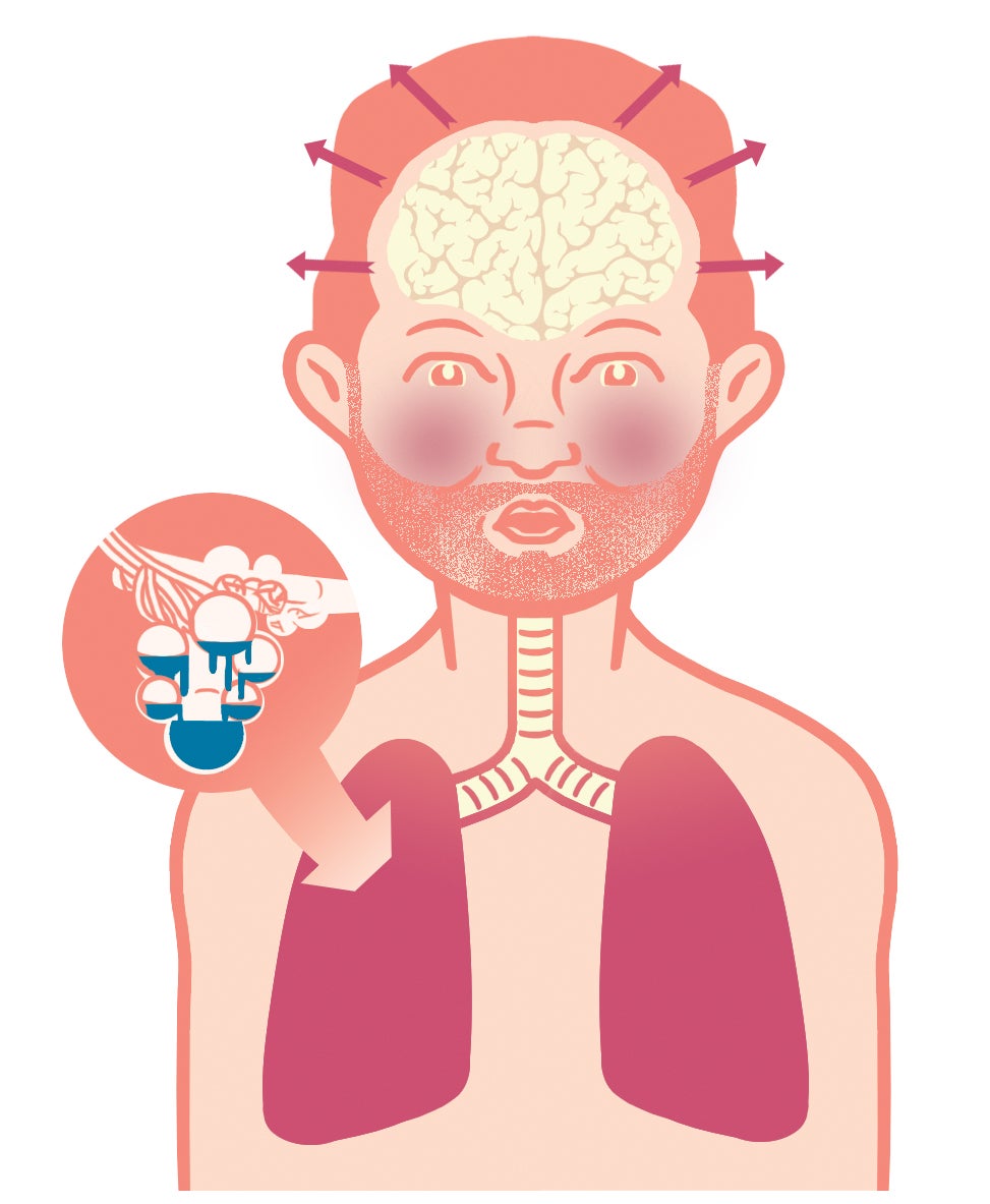 lungs-illo Lung Issues
